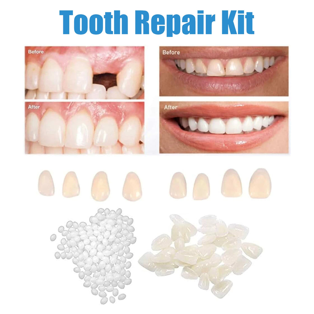 30g Temporary Tooth Repair Moldable Teeth And Gaps False Tooth Solid Gel Adhesive Fake Teeth Beauty Tool Dental Supplies