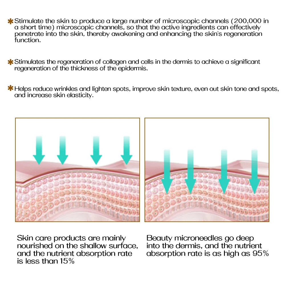 Professional 540 Needles for Facial Body Hair Growth Derma Roller for Skin Beard 0.2mm 0.25mm 0.3mm Needle Beauty Roller