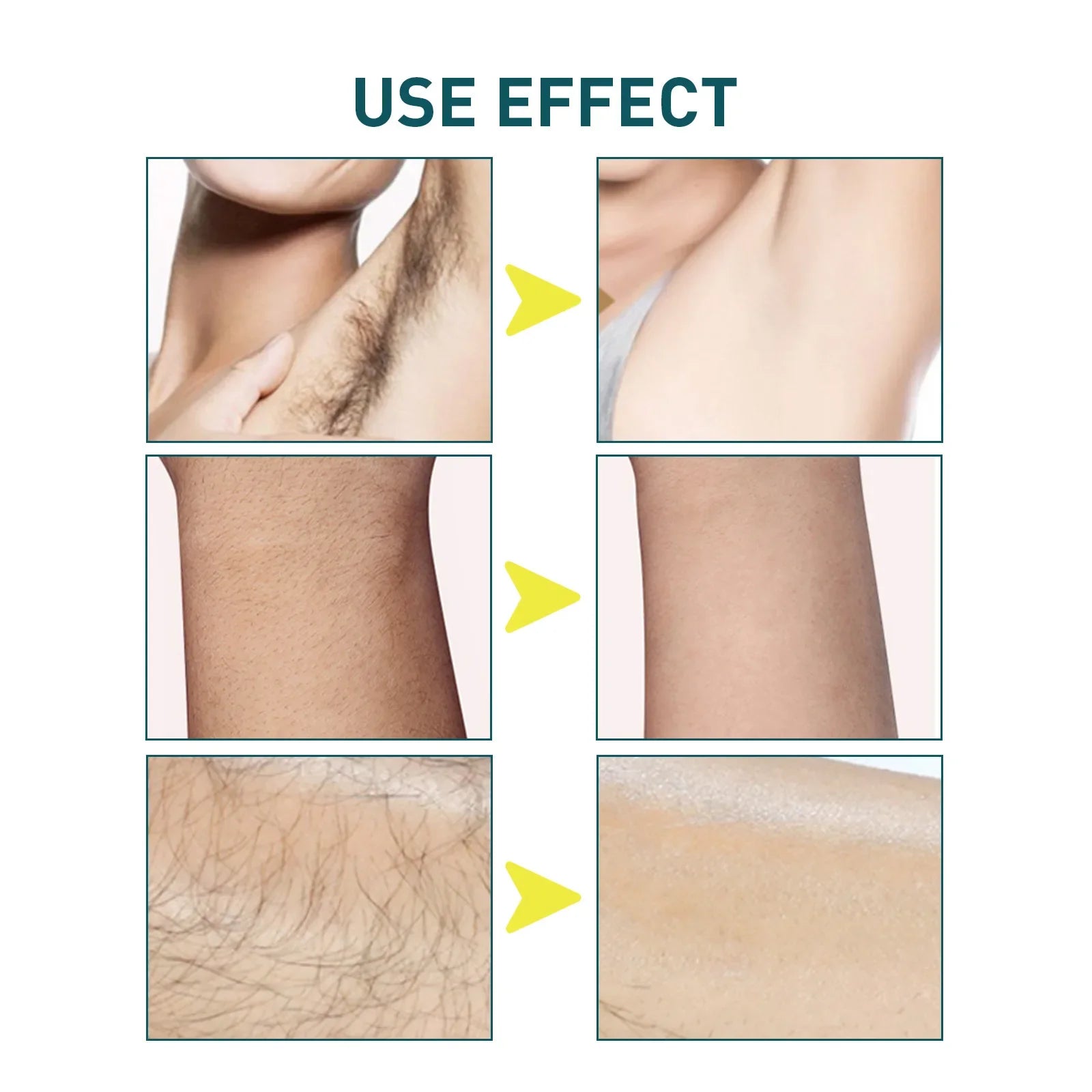 Hair Removal Wax Strips Professional Mild Nonwoven Body Depilation For Face Legs Bikini Underarm Arm Summer Epilator Beauty Tool