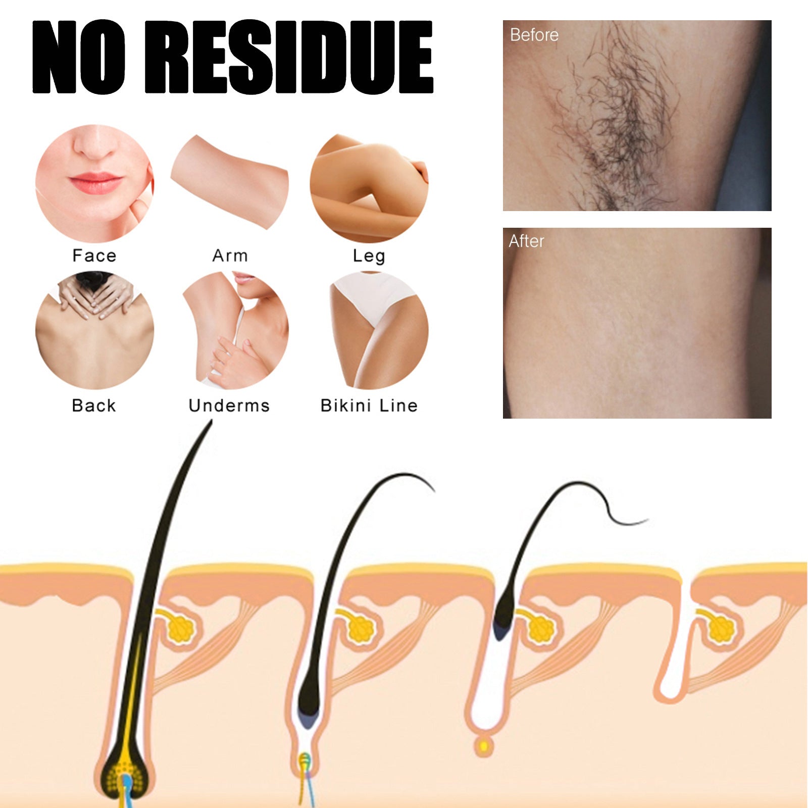 Hair Removal Wax Strips Professional Mild Nonwoven Body Depilation For Face Legs Bikini Underarm Arm Summer Epilator Beauty Tool