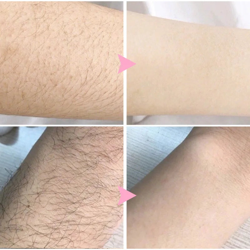 Sakura Hair Removal Cream Fast Painless Hair Growth Inhibitor Arm Armpit Legs Intimate Areas Permanent Depilatory for Men Woman