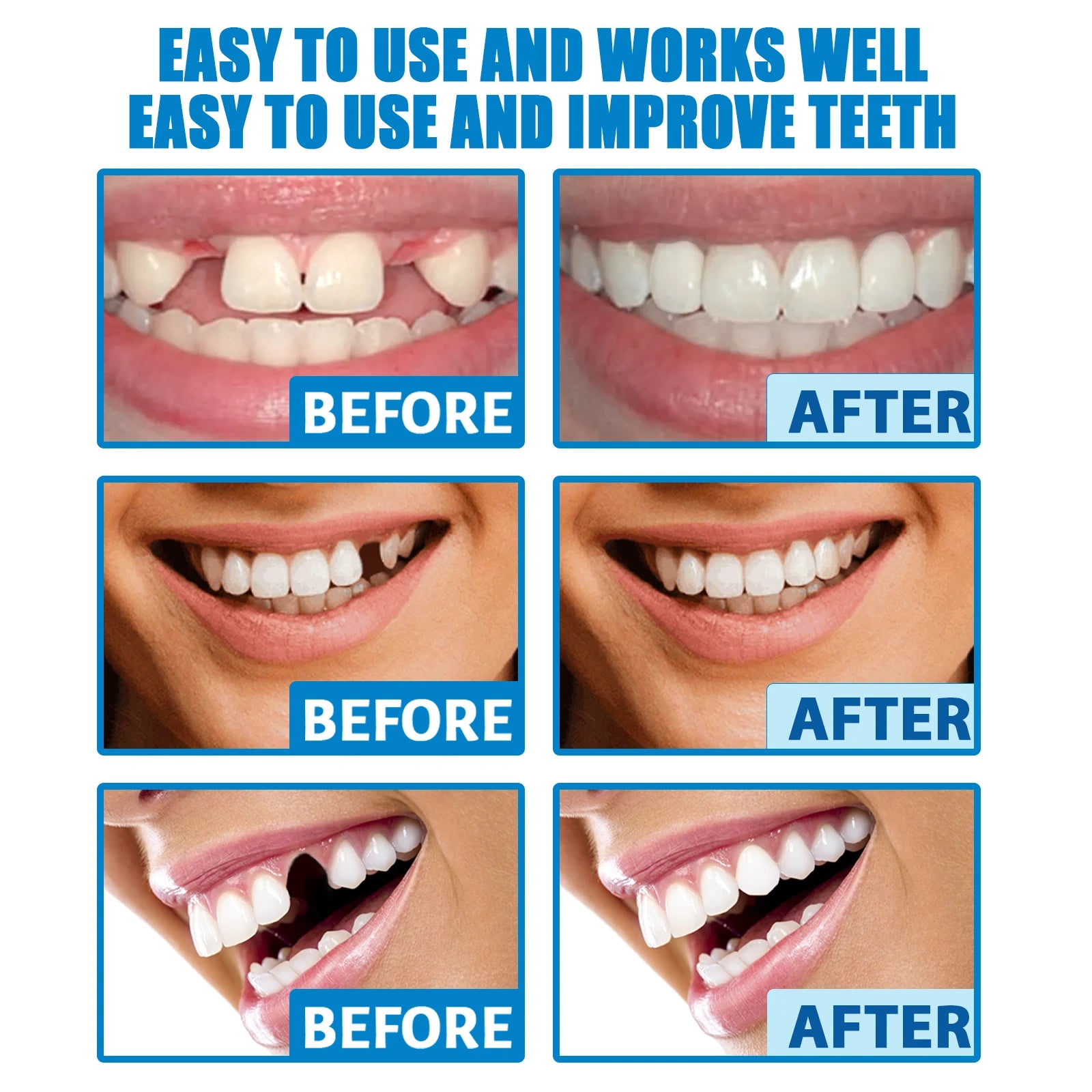 30g Temporary Tooth Repair Moldable Teeth And Gaps False Tooth Solid Gel Adhesive Fake Teeth Beauty Tool Dental Supplies