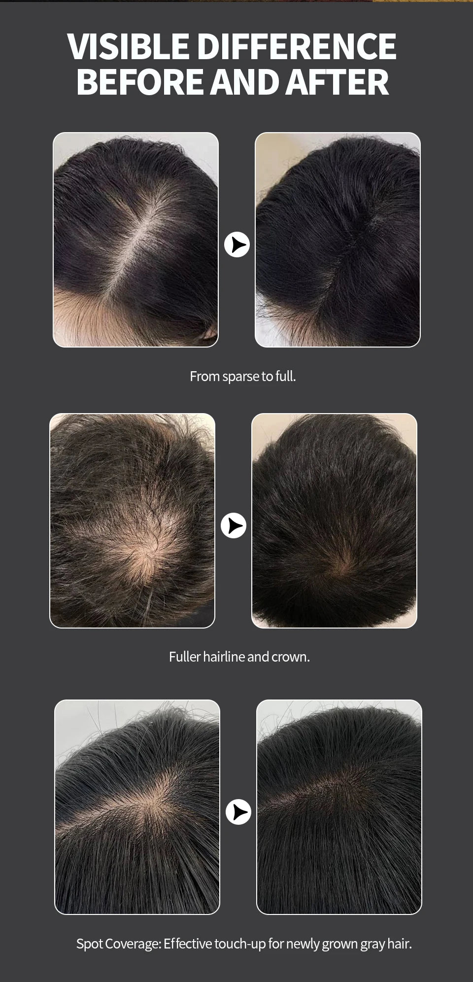 LEWEDO Hair Fiber Powder 25g Keratin Hair Building Fiber Hair Regrowth Powder Hair Styling Powder Hair Loss Hair Growth Product