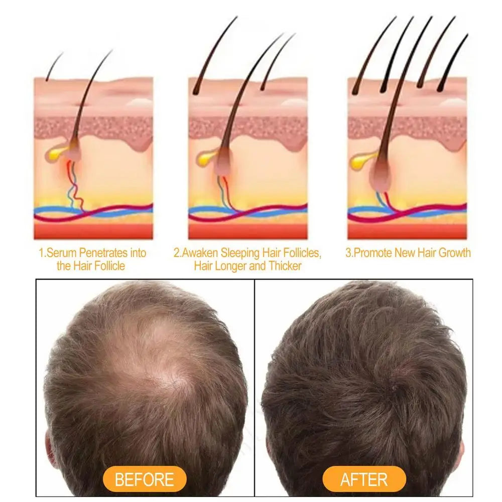 Herbal Ginger Hair Shampoo Hair Growth No Silicone Oil Control Anti Dandruff Itching Cleansing Professional Hair Treatment 100ml