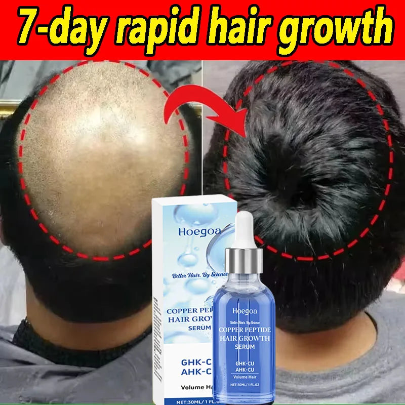 Major Hair Growth Essence Tough Care Hair Improve Dry Scalp Wash Free Hair Care Nourishment Oil Anti Alopecia Hair Care