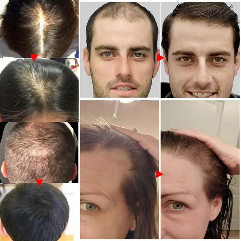 Major Hair Growth Essence Tough Care Hair Improve Dry Scalp Wash Free Hair Care Nourishment Oil Anti Alopecia Hair Care