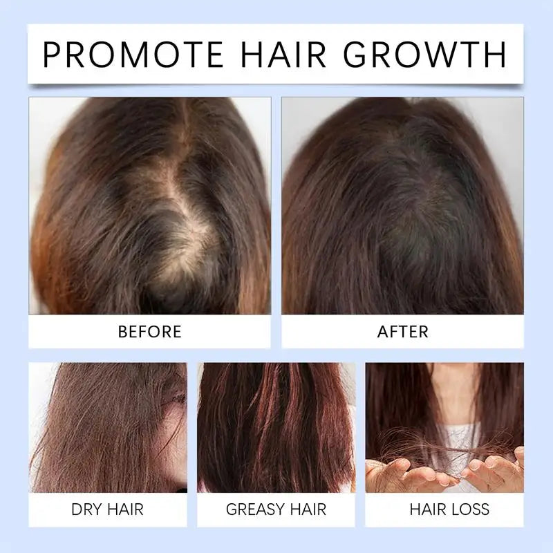 Major Hair Growth Essence Tough Care Hair Improve Dry Scalp Wash Free Hair Care Nourishment Oil Anti Alopecia Hair Care