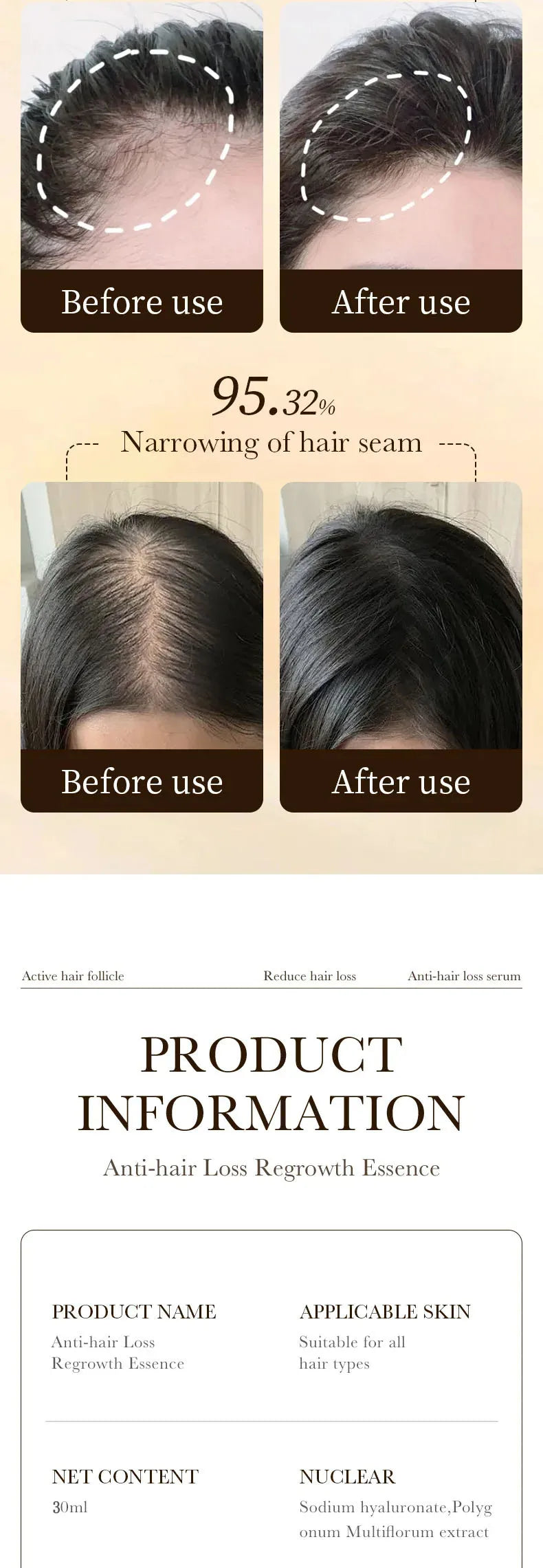 Hair Growth Essential Loss Regrowth Treatment Strengthens Hair Nourishes Scalp Light Weight Non Greasy Improve Scalp Circulation