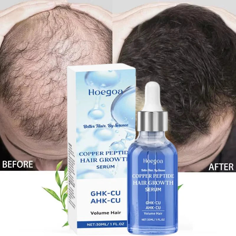 Major Hair Growth Essence Tough Care Hair Improve Dry Scalp Wash Free Hair Care Nourishment Oil Anti Alopecia Hair Care