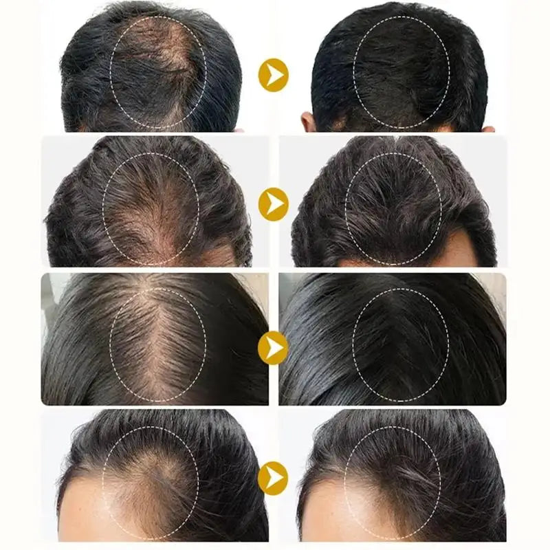 Major Hair Growth Essence Tough Care Hair Improve Dry Scalp Wash Free Hair Care Nourishment Oil Anti Alopecia Hair Care